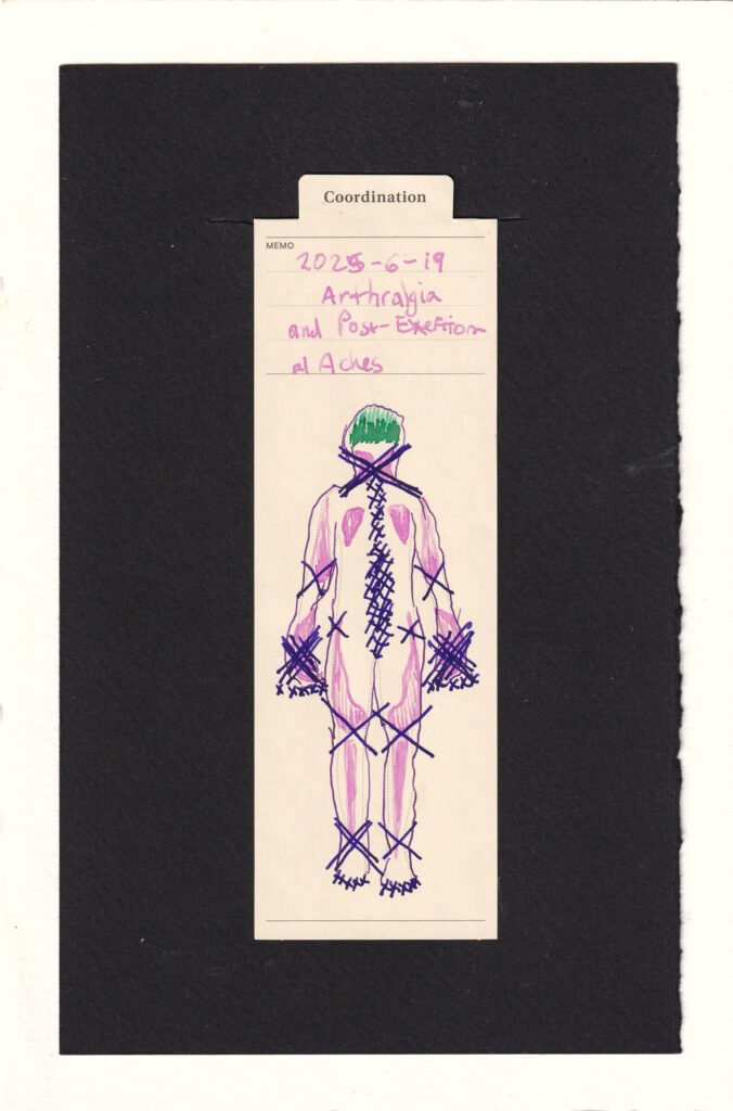 the figure is shakily outlined in a fine purple line. Someone especially astute would notice that arthralgia, or joint pain, is causing this instability. There are soft pink mostly-symmetrical areas of aches, the neck, arms, hands, thighs, and a couple others. The dark purpl makes X marks over the joints with pain. The largest most repeated Xs mark the neck and hands. Many many small Xs rise up the spine, and medium Xs on the elbows, hips, and knees. The top of the head is in a vibrant contrasting green, vertical lines in different shades of the same color. Perhaps it is yet another head pain day. Oh! And a bunch of tiny Xs, five on each apendage mark the fingers and toes