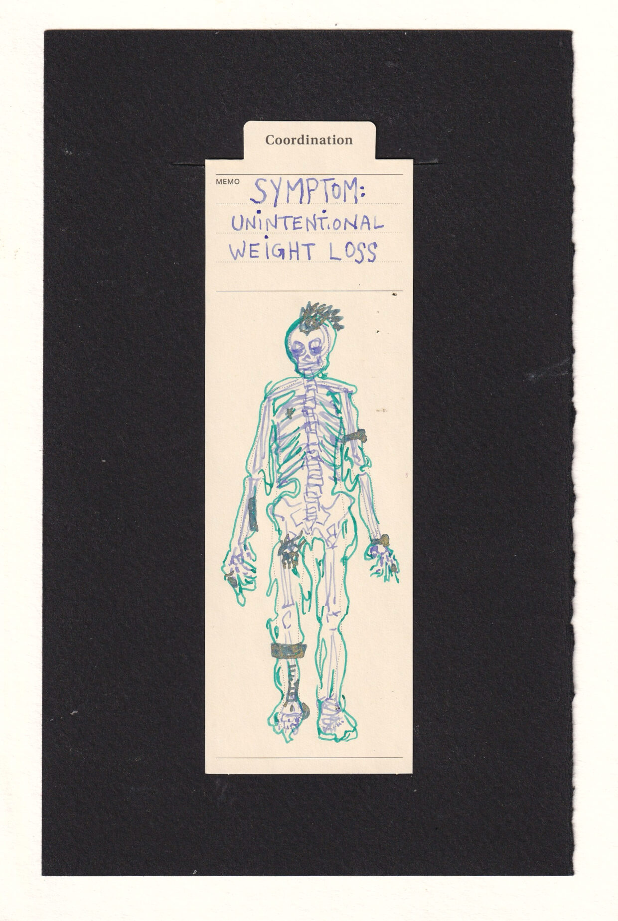 drawing jagged lavender skeleton, with a loose teal outline sagging and melting off of them, both tight to the bones and hanging limply under gravity. the skeleton is personalized by showing a mohawk, two hear rate monitors, two tattoos, surgical hardware, prosthetic and many small scars.