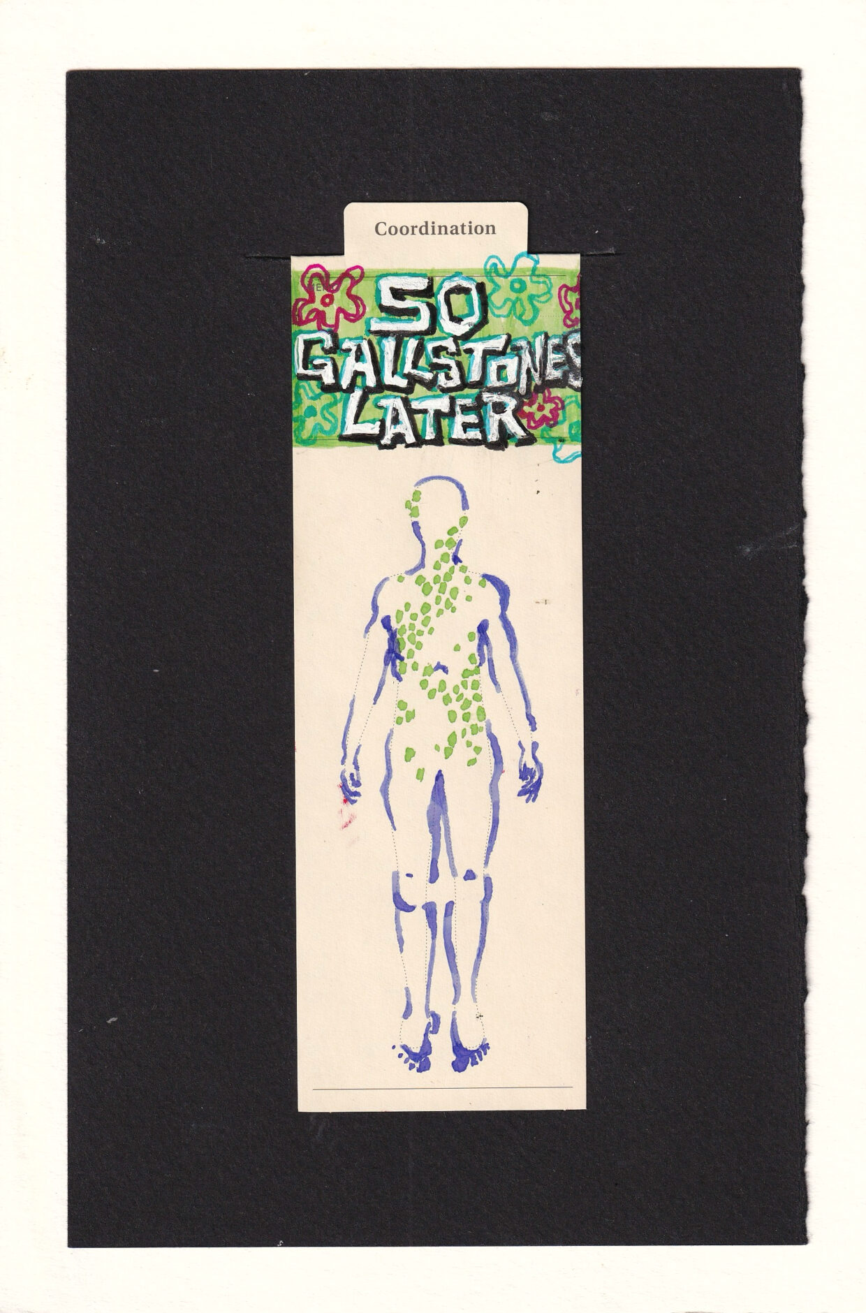 manila anatomical bookmark with a figure with approximately 50 pale lime green lumps in them, most in the abdomen forming a loose trailing pattern, with the pattern rising up into the neck and face, and a few around the hips. the rest of the figure is only partially rendered in pale purple curves. At the top in the memo section, reads " 50 Gallstones Later ". It is on a background of light vibrant green with blue and red abstract flowers. The letters are geometric and jagged and irregular. for only the most cultured amongst us, one might notice a striking similarity to the time cards of Sponge Bob Square Pants