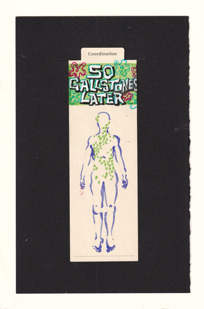 manila anatomical bookmark with a figure with approximately 50 pale lime green lumps in them, most in the abdomen forming a loose trailing pattern, with the pattern rising up into the neck and face, and a few around the hips. the rest of the figure is only partially rendered in pale purple curves. At the top in the memo section, reads " 50 Gallstones Later ". It is on a background of light vibrant green with blue and red abstract flowers. The letters are geometric and jagged and irregular. for only the most cultured amongst us, one might notice a striking similarity to the time cards of Sponge Bob Square Pants