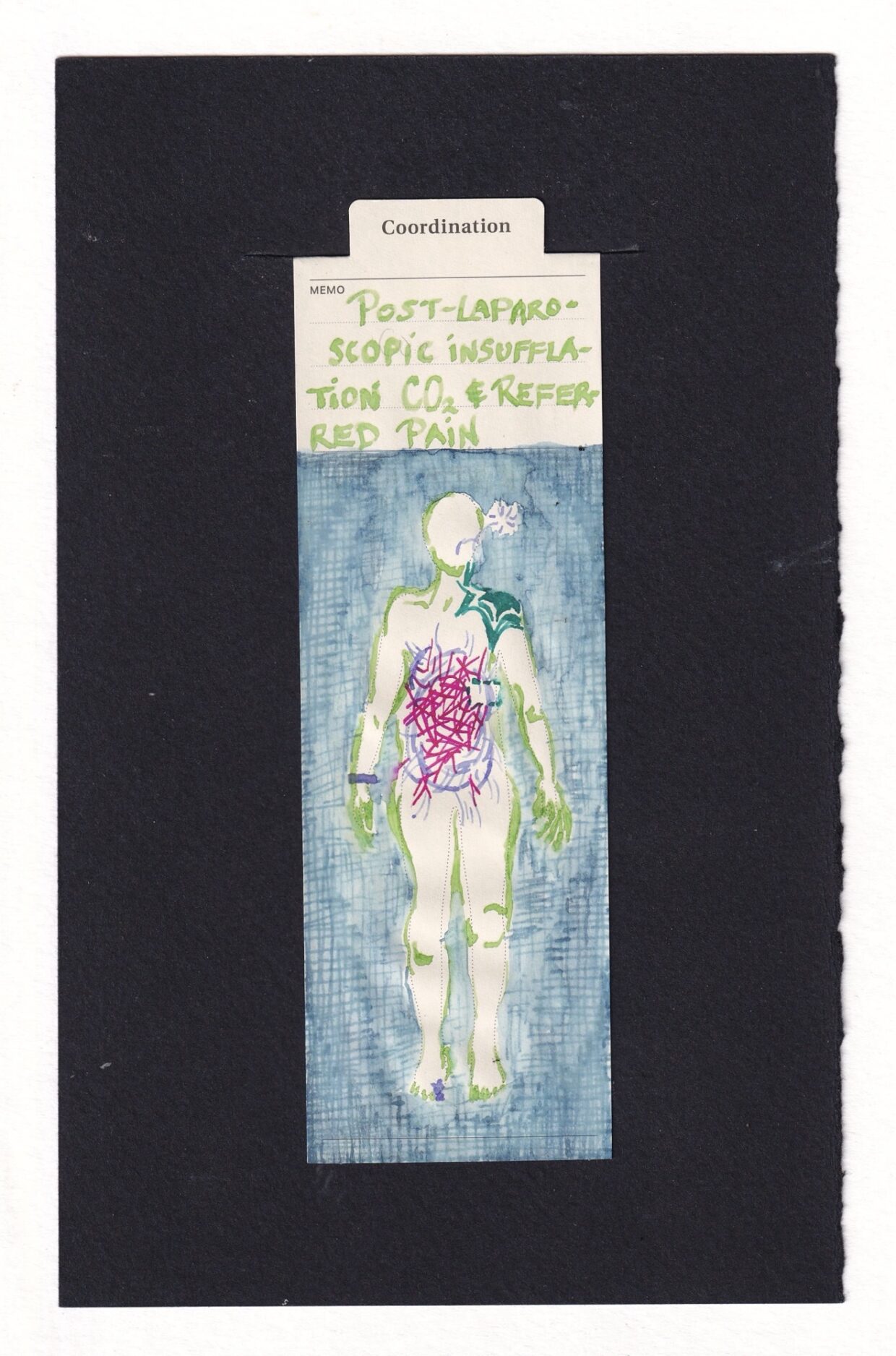 Manila bookmark with human figure drawn in vibrant tertiary colors, their outline is drawn in layered minimal curved lines and lime green. Their stomach has pale lavender significant bulging and strain lines. Within it are neon pink sharp straight lines, like a bunch of sticks in a pile. Where the gallbladder should be is a teal dashed outline, and in the same teal the shoulder has layered bursting. Coming out of the figure’s would-be mouth is a purple spiral and pop like a burp or hiccup. The background is a much less vibrant medium blue, a mix of textures, criss crossed hatched lines, then blurry watery effects. At first it almost seems like a relaxing pool, but the crossed line texture becomes more apparent, it starts to give an itchy, clinical, medical / surgical drape vibe. At the top of the bookmark in the memo section like green handwriting reads “post-laparoscopic insufflation CO2 & referred pain”. They have a pale purple band around a wrist, hospital bracelet.